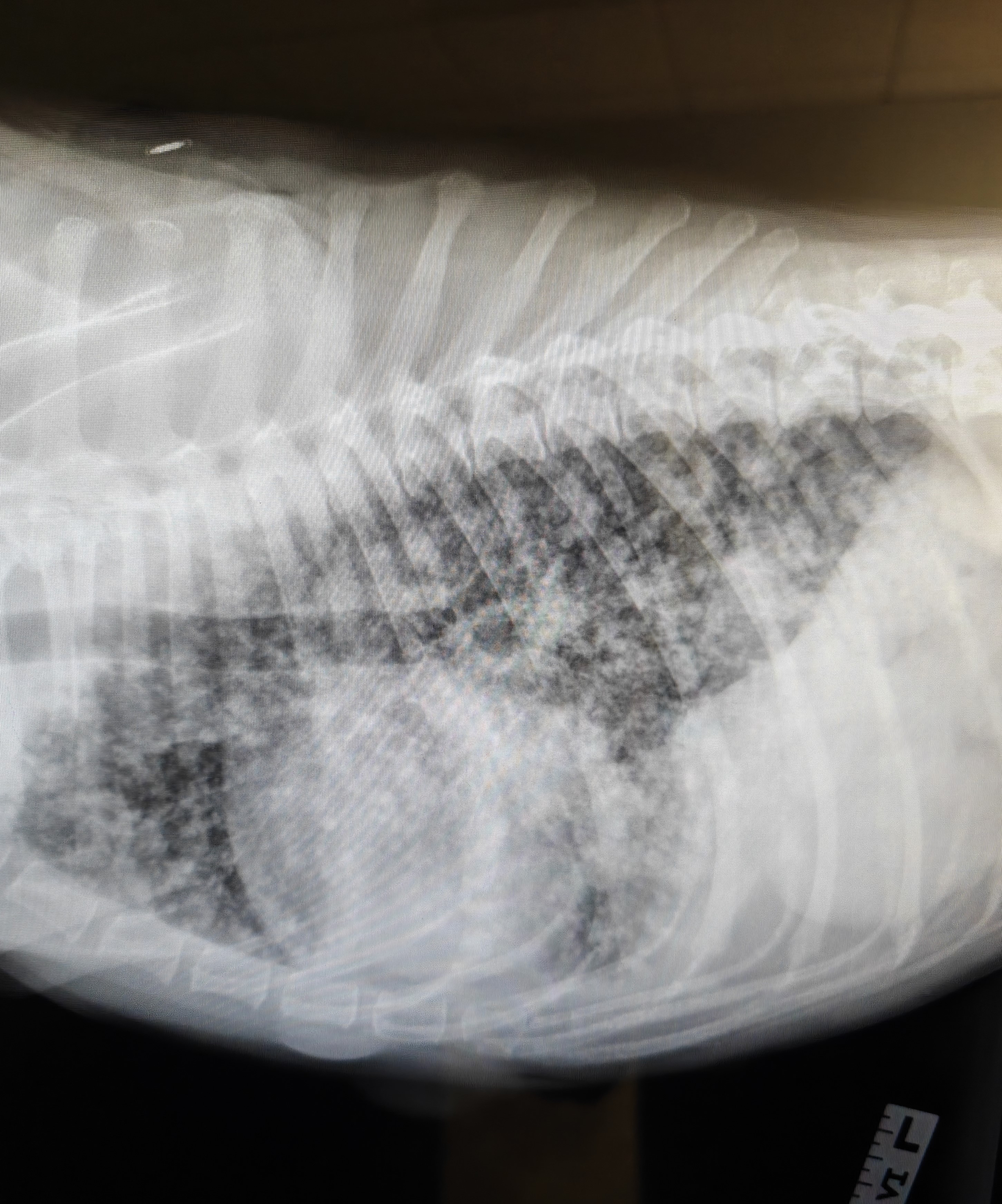 Apollo's lungs